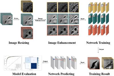 Deep learning-driven ultrasound-assisted diagnosis: optimizing GallScopeNet for precise identification of biliary atresia